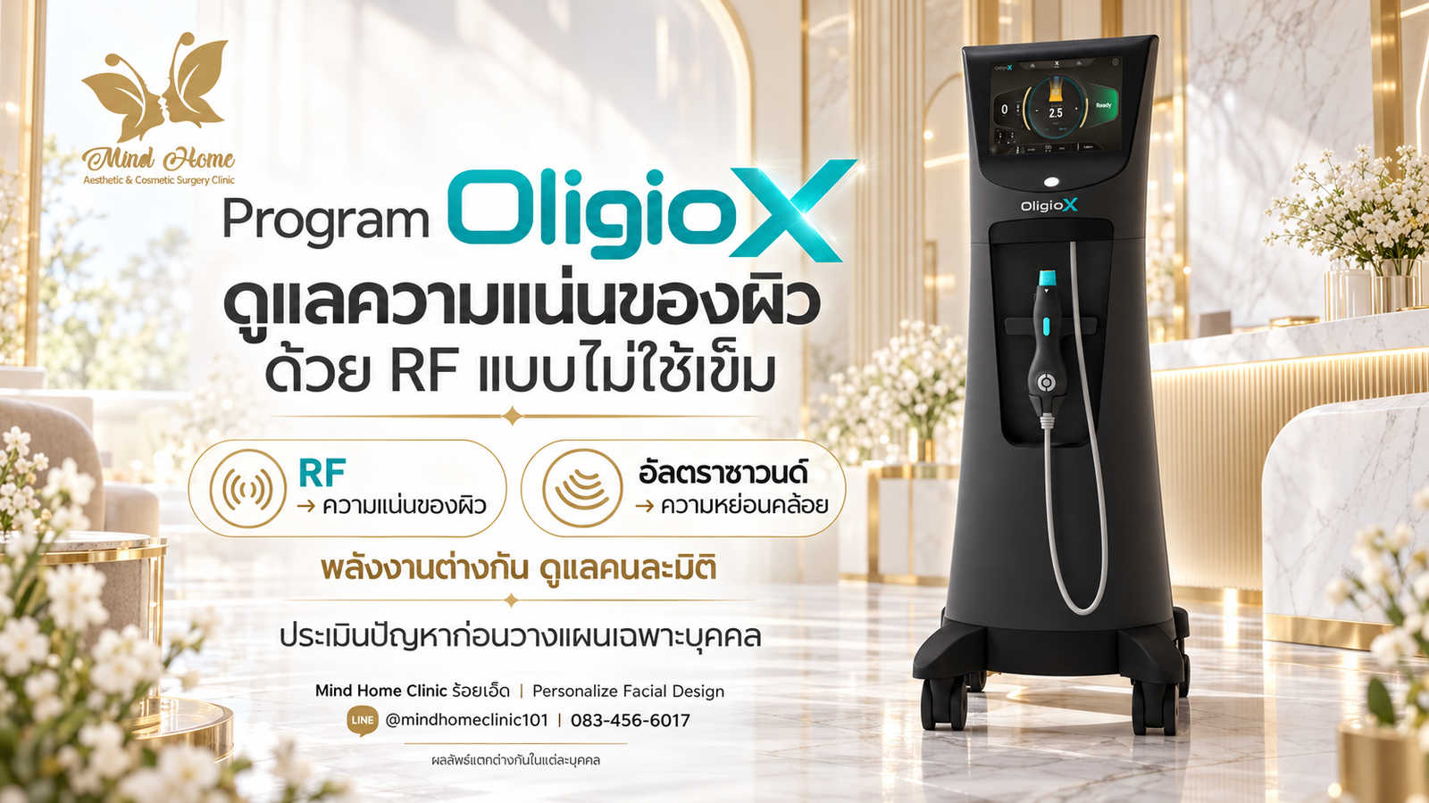 ทำความรู้จัก Program OligioX เทคโนโลยีคลื่นวิทยุ RF แบบไม่ใช้เข็มดูแลความแน่นของผิว และความต่างจากกลุ่มอัลตราซาวนด์ ที่ Mind Home Clinic ร้อยเอ็ด